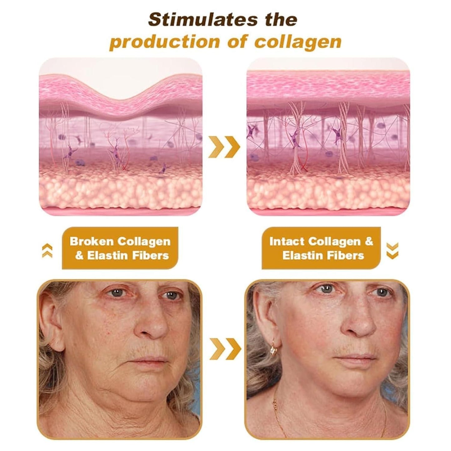 BeeTox™ - Bee Venom Wrinkle Repair Cream [Buy 1 Get 1 Free]